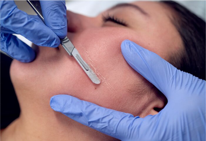 Best dermaplaning in Bal Harbour